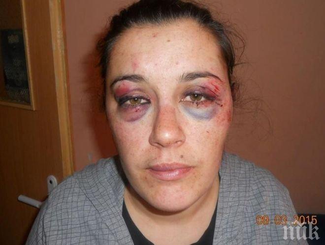 Бунт в Самоков! Искат честен процес срещу насилници, пребили зверски дама на 8 март	