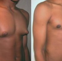 Mъже се сдобиват с бюст от телешко, тъпкано с женски хормони