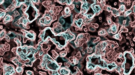 бактерия причинява затлъстяването