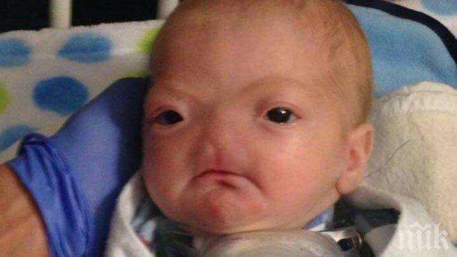 Роди се бебе без нос (видео)