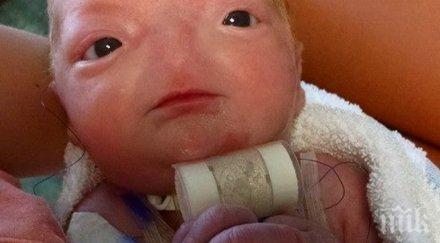 съдбата бебче толкова рядък случай никой забелязва майката изживява всичко сама