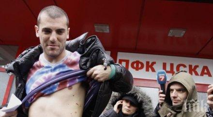 стефан николич показа белезите зверския ритник моци