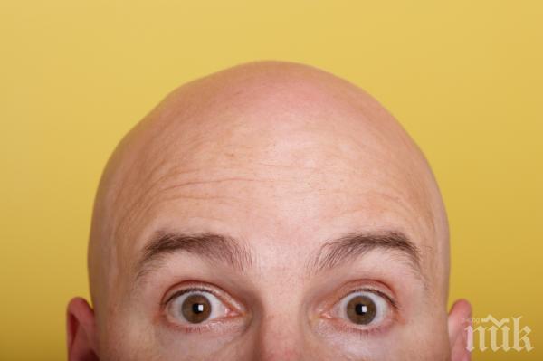 Съд отказа на плешивец безплатни перуки