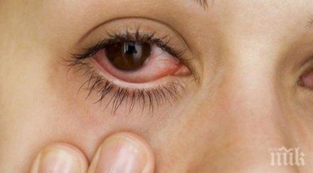 летен вирус удря очите
