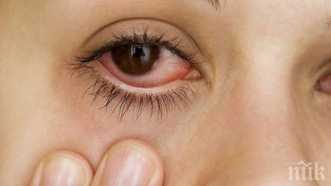 Летен вирус удря в очите