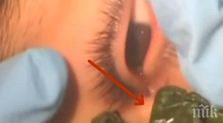 офталмологът погледна микроскопа установи нещо окото тинейджър