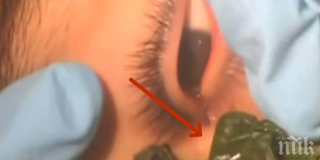 Когато офталмологът погледна през микроскопа... установи, че нещо живее в окото на тинейджър...