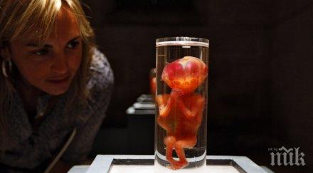 уникум жена била бременна години без знае