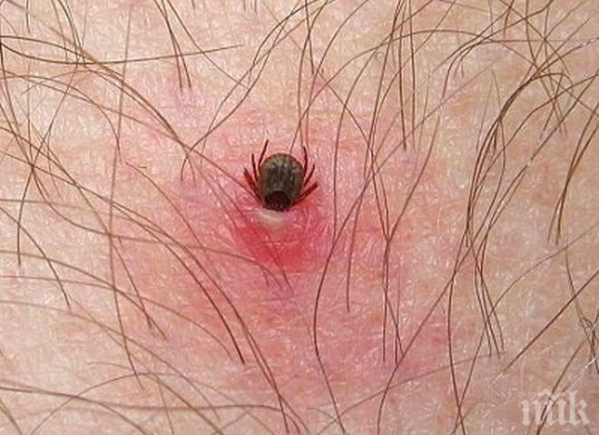 Расте броят на ухапаните от кърлежи в Пловдив
