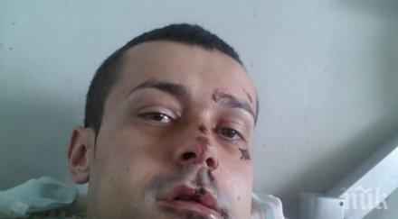 първо пик изроди обезобразиха без причина колоездач сърцето люлин ивайло шок видял лицата нападателите