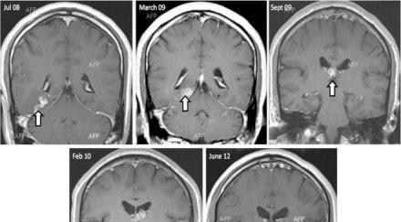 изследователи създадоха изкуствени неврони
