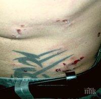 Скандално! Куче брутално нахапа момче и момиче. Медиите мълчат (снимки)