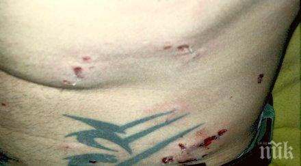 скандално куче брутално нахапа момче момиче медиите мълчат снимки