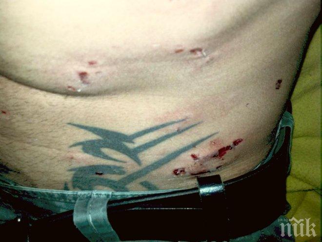 Скандално! Куче брутално нахапа момче и момиче. Медиите мълчат (снимки)