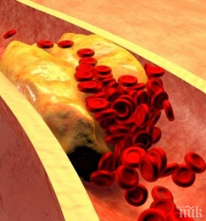 Нова технология открива рано атеросклерозата