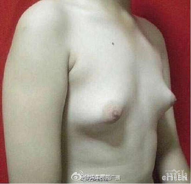 Невероятно! Мъж се сдоби с ци*и заради хормони в пилешкото