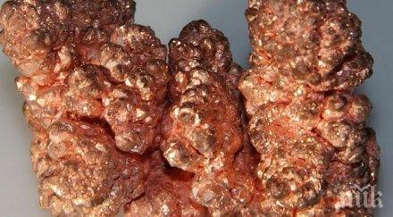 въпреки лошите прогнози цената медта покачи