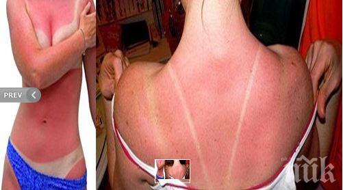 Слънцезащитните кремове предпазват само наполовина, вижте какво става с кожата ни