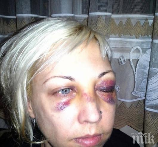 Жестоко пребита от полицай жена осъди МВР! Дължат й 25 бона