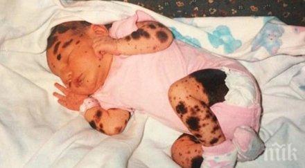 новородено бебе беше покрито стотици петна видиш години късно