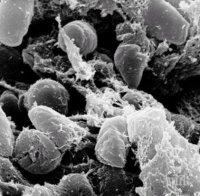 Американската здравна служба предупреди за 11 случая на чума в САЩ