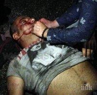 Невиждана агресия! Пребиха хасковлия до смърт - той си глътна езика 
