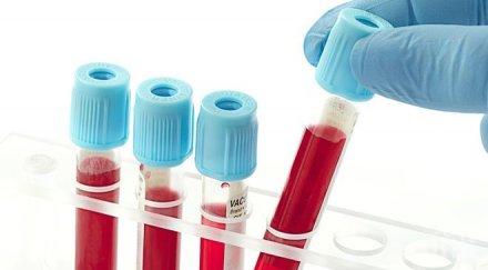 тест засичащ размера тумора рак простатата спаси хиляди пациенти