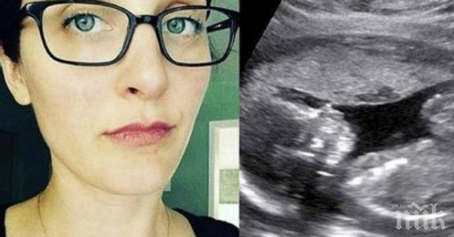 Защо тази жена качи публично снимка на ултразвук в социалната мрежа? Защо тази снимка обиколи интернет? Прочети и се замисли!