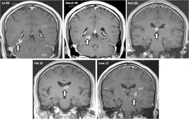Карта на мозъчната активност служи като „пръстов отпечатък“