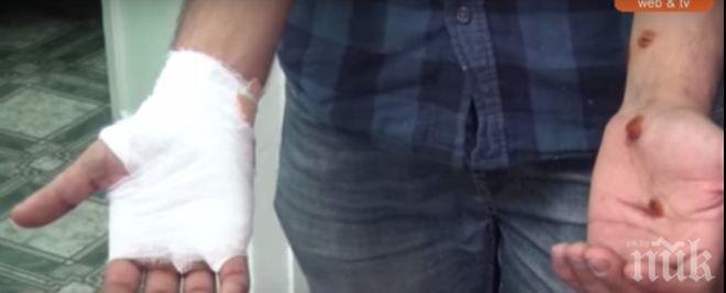 Работници бяха нахапани жестоко от кучета край Пловдив