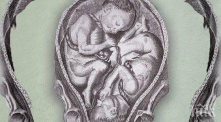 ами нероден близнак оказа баща детето брат