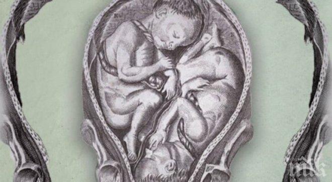 Ами сега? Нероден близнак се оказа баща на детето на брат си