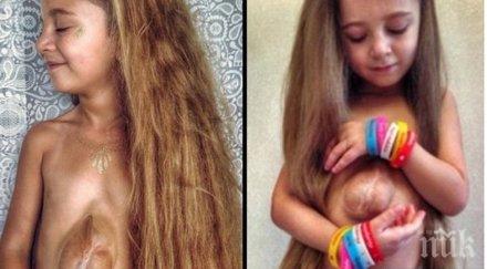 годишно момиче страда рядка аномалия нейното сърце намира