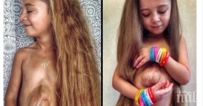 6 годишно момиче страда от много рядка аномалия, нейното сърце се намира...