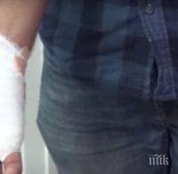 Шуменската община плаща 6000 лева на ухапано дете