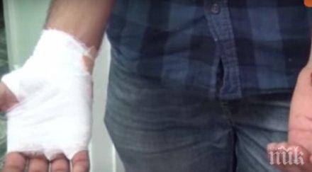 шуменската община плаща 6000 лева ухапано дете