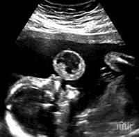 Неродено бебе е заснето с ултразвук как прави балончета. Това се оказва фатално, защото...