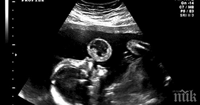Неродено бебе е заснето с ултразвук как прави балончета. Това се оказва фатално, защото...