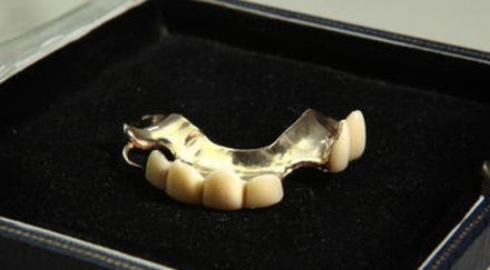 данъчни продават търг златни зъби длъжник