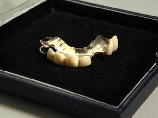 Данъчни продават на търг златни зъби на длъжник!