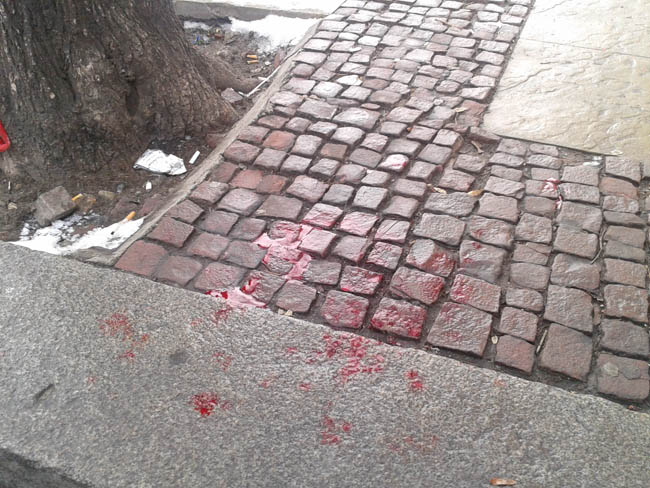 Оперират Баретата в Пирогов