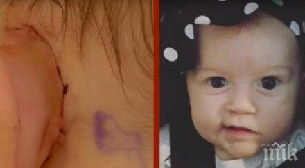 млада майка забелязва нейното дете смее странно завежда преглед всички шокирани