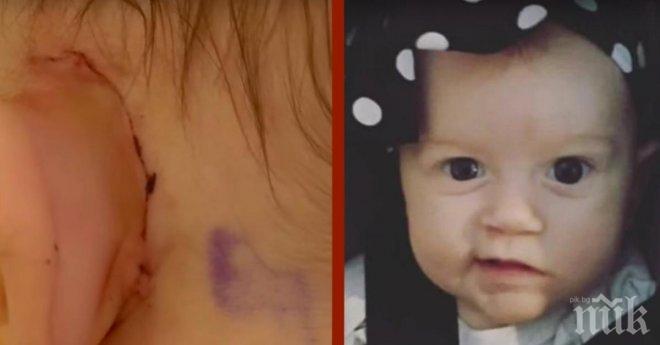 Млада майка забелязва, че нейното дете се смее много странно. Когато го завежда на преглед, всички са шокирани!!!