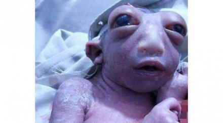 зловещо момиче половин глава роди индия очите изцъклени