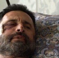 Пребиха жестоко най-крадения фермер във Видинско