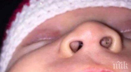 майка забеляза черни точки носа бебето предупреждава всички опасността