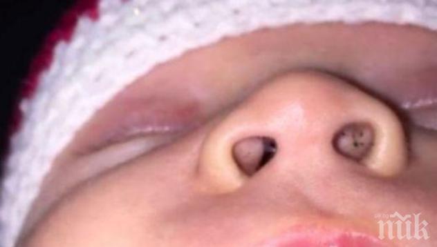 Майка забеляза черни точки в носа на бебето си и сега предупреждава всички за опасността