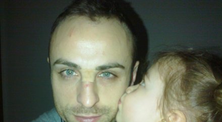 берба получи лечебна целувка щерката деа