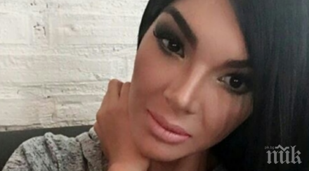 годишна жена извади всички зъби претърпя козметични операции резултатите оставят без думи