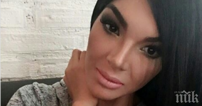 Тази 26-годишна жена си извади всички зъби и претърпя 20 козметични операции. Резултатите ме оставят без думи.